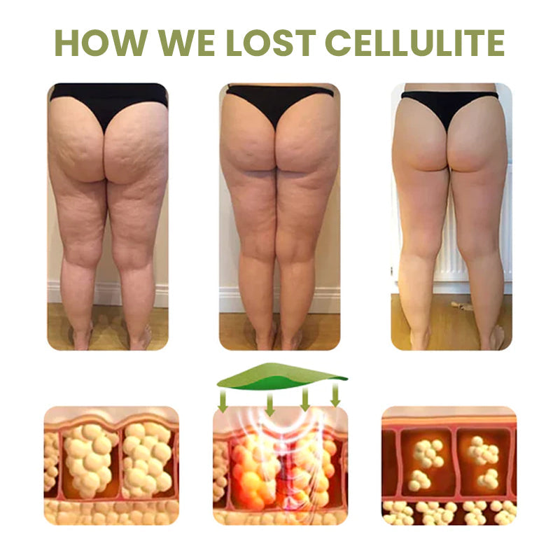 Dr. Slim™ Cellulite Reduction Patches🎉Limited Time Offer