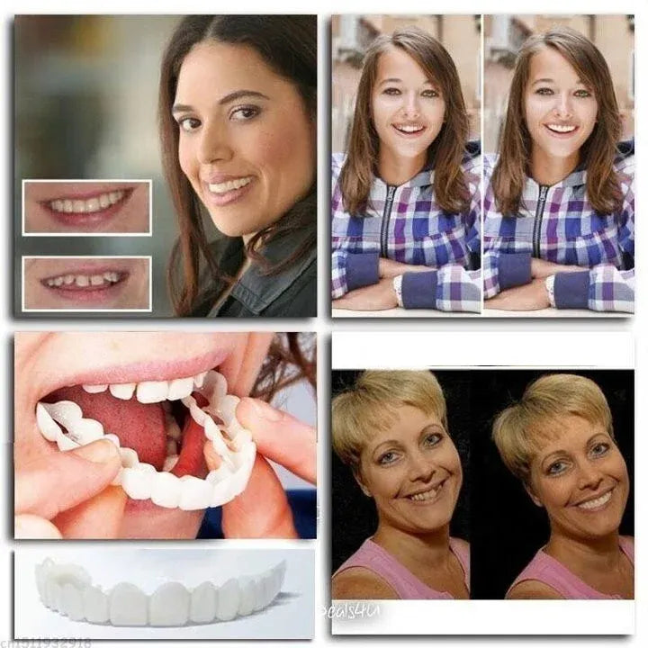 🔥LAST DAY 50% OFF🔥Latest Adjustable Snap On Dentures